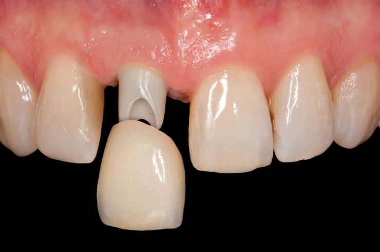 Sanvi Dental Care