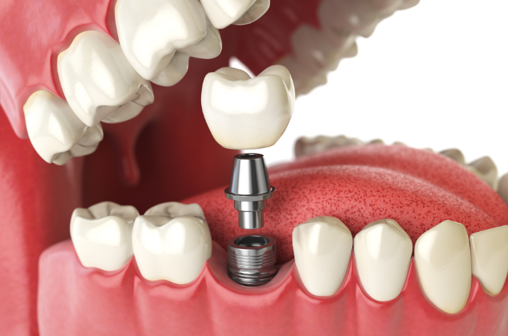 Sanvi Dental Care