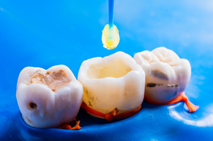 Sanvi Dental Care