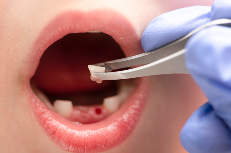 Sanvi Dental Care