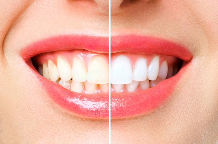 Sanvi Dental Care